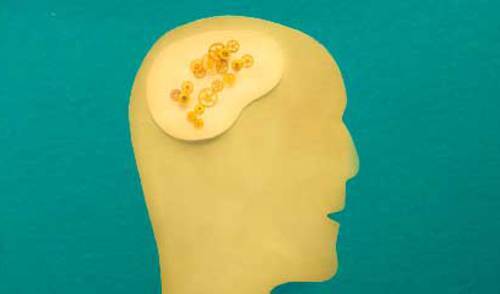 Porijeklo i fluktuacija velikog volumena cerebrospinalne tekućine Porijeklo i fluktuacija velikog volumena cerebrospinalne tekućine